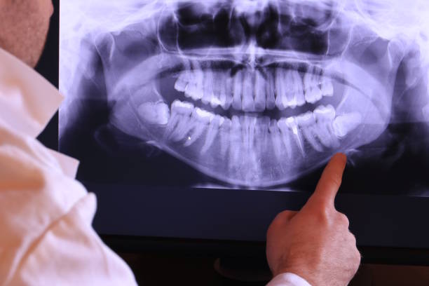 Best Emergency Dentist for Knocked-Out Tooth in Ten Mile Creek, MD