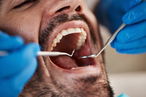 Best Emergency Dental Care for Abscessed Tooth in Ten Mile Creek, MD